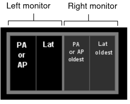 PA and Lat view