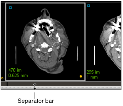 Separator bar