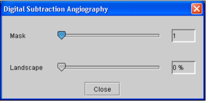 Digital Subtraction Angiography dialog