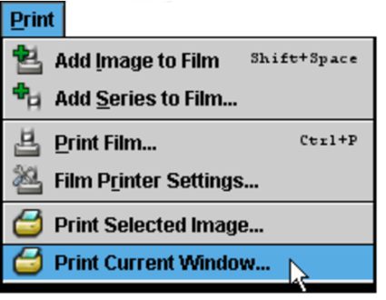 Print menu