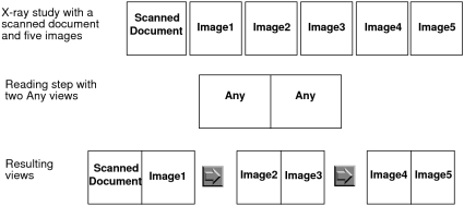Example of X-ray study with reading steps