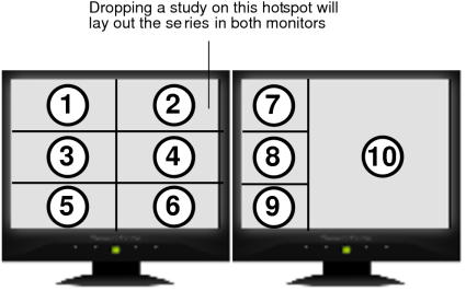 Symmetrical and asymmetrical series layout in both monitors