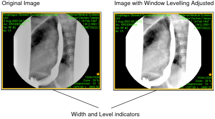 Width and level indicators