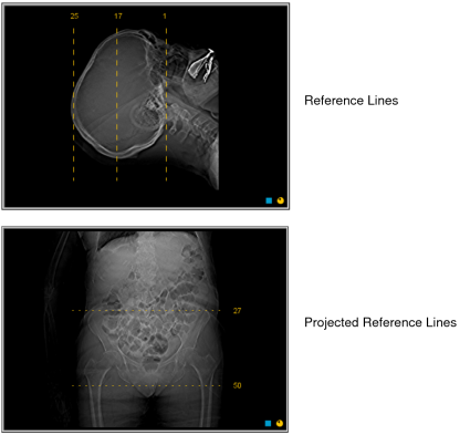 Reference lines