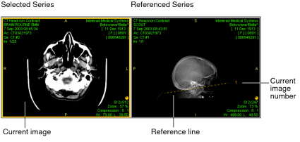 Reference line