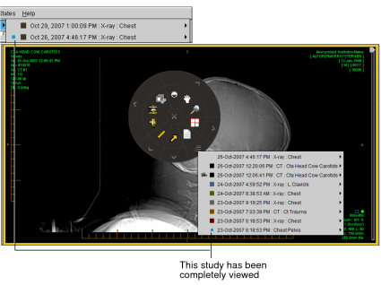 Study is being viewed