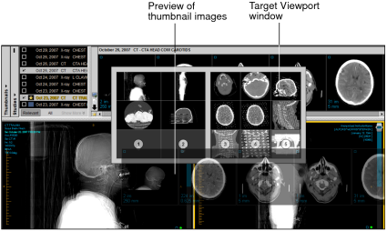Drag study onto hotspot