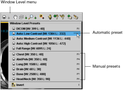 Window Level  menu
