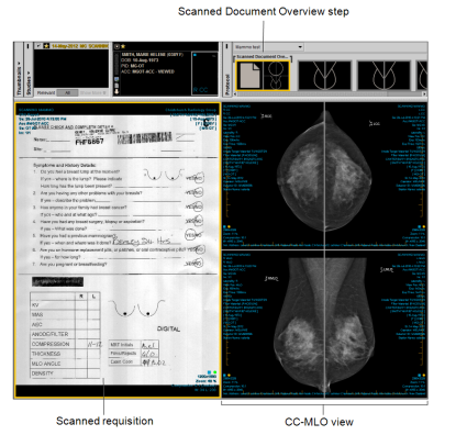 Scanned documents in mammography studies