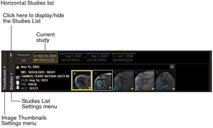 Horizontal Studies list