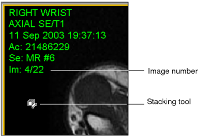 Text overlay information