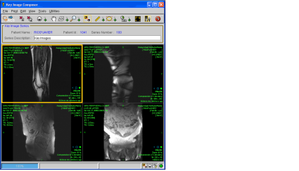 Adding Key Images to a Study