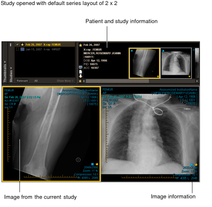 Study opened with default series layout of 2 x 2