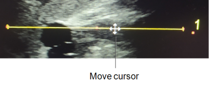 Move cursor