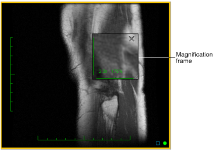 Magnification frame