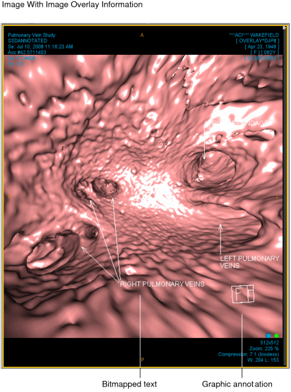 Image with overlay information