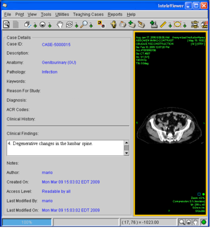 Teaching Case Viewer