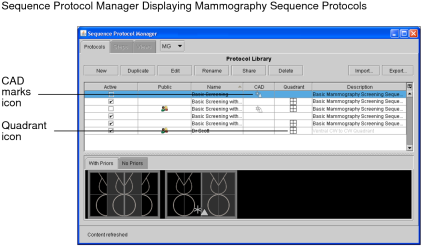 Sequence Protocol Manager for Mammo