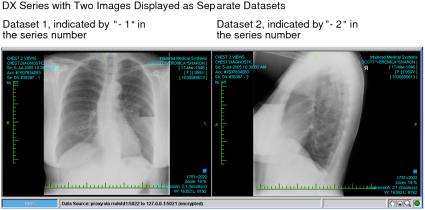 DX series with two images displayed as separate datasets