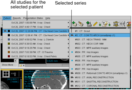 Studies and series for selected patient