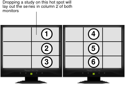 Series layout in column 2 of both monitors