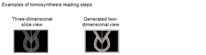 Examples of tomosynthesis reading steps