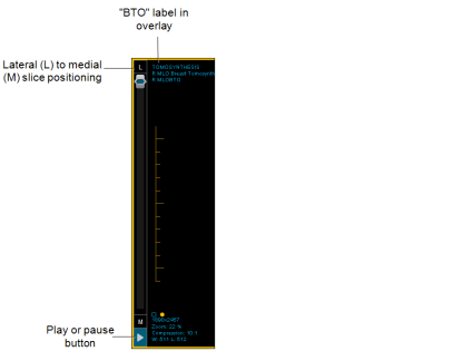 Tomosynthesis viewport