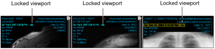 Locked viewport