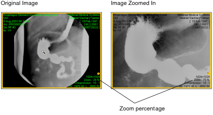 Zoomed image