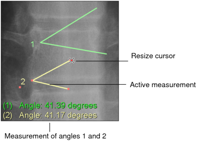 Multiple simple angles