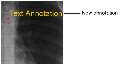 New annotation