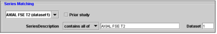 Series Matching option
