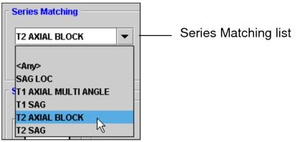 Series Matching list