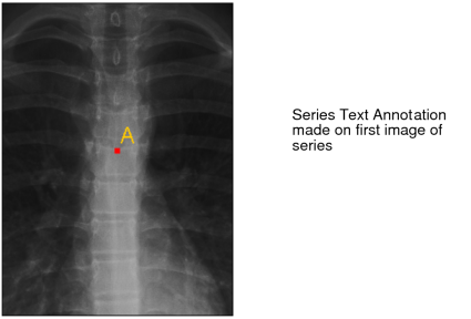 Series text annotation
