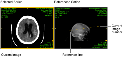 Reference line and image number