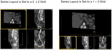 2x2 symmetrical series layout