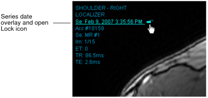 Series date overlay and open Lock icon
