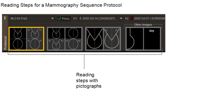 Reading Steps for a Mammography Sequence Protocol