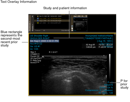 Text overlay information