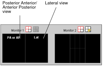 PA/AP and Lat View