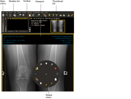 InteleViewer interface