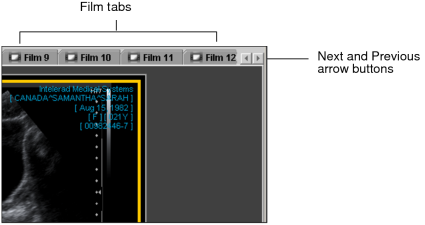 Film tabs