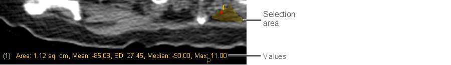 Measuring Freehand Areas