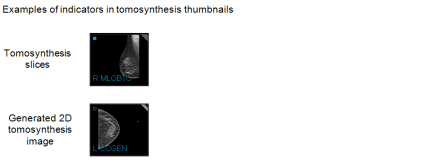 BTO and GEN indicators