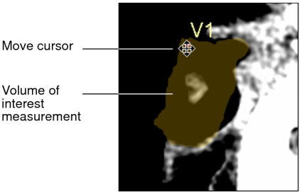 Move cursor over VOI measurement
