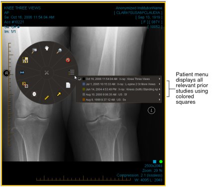 UI elements showing multiple priors color scheme