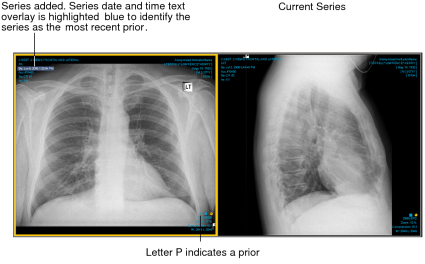 Current series and added series