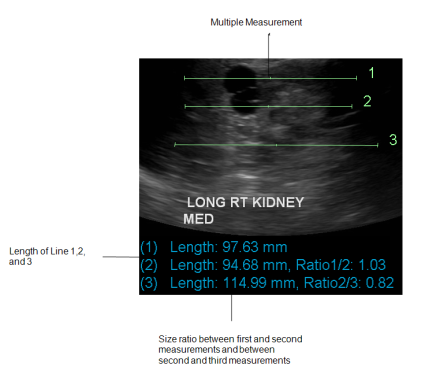 Multiple measurements