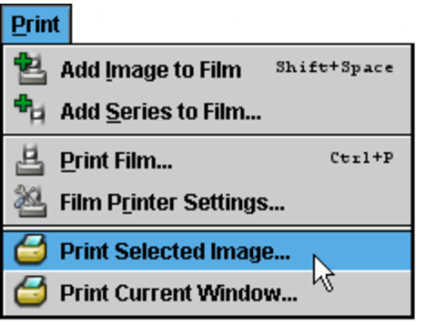 Print Selected Image