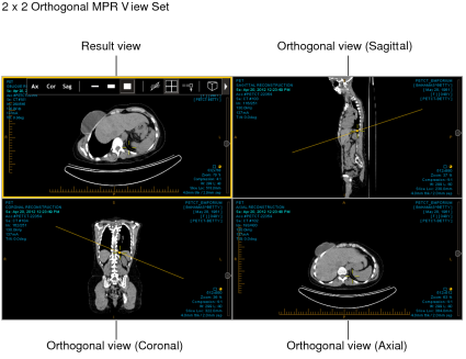 2x2 orthogonal MPR view set